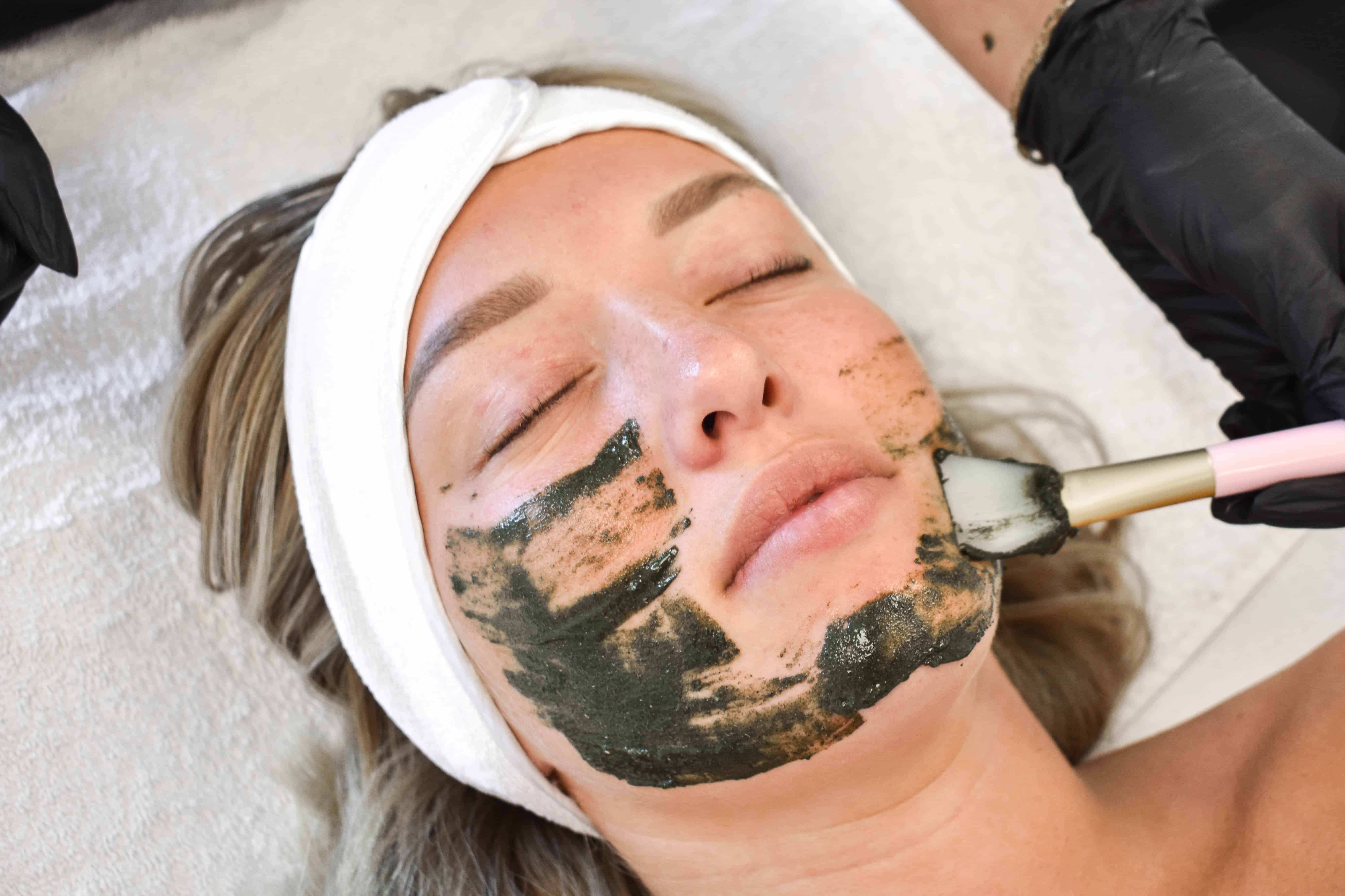 Kruidenpeeling acne